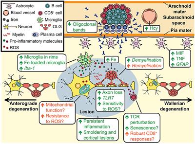 Potential biological contributers to the sex difference in multiple sclerosis progression